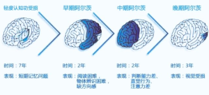 阿尔茨海默病轻度认知障碍的预防-网络宝藏