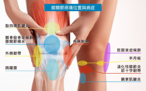 膝盖使用说明书(更新版)-网络宝藏