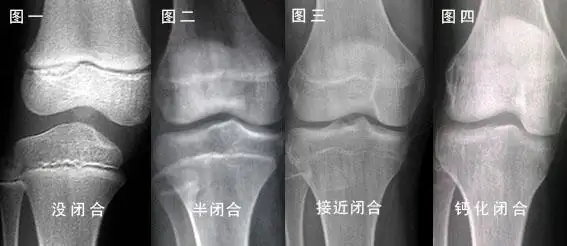 成年后怎么样才能再次长高?-网络宝藏