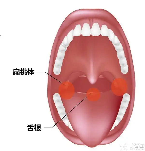 被鱼刺卡住喉咙怎么办？-网络宝藏